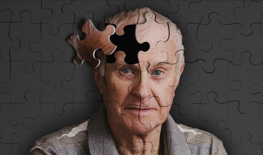 alzheimer-1