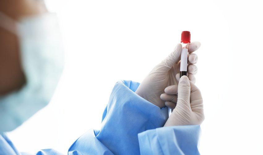 Doctor holding a blood test tube